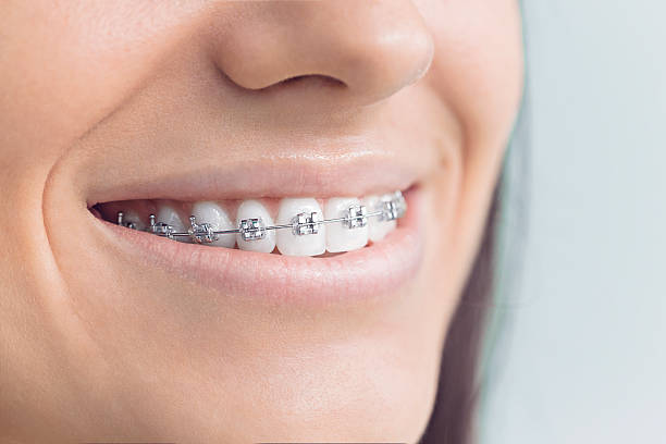 Best Dental Fillings (Composite and Amalgam)  in Hesston, KS